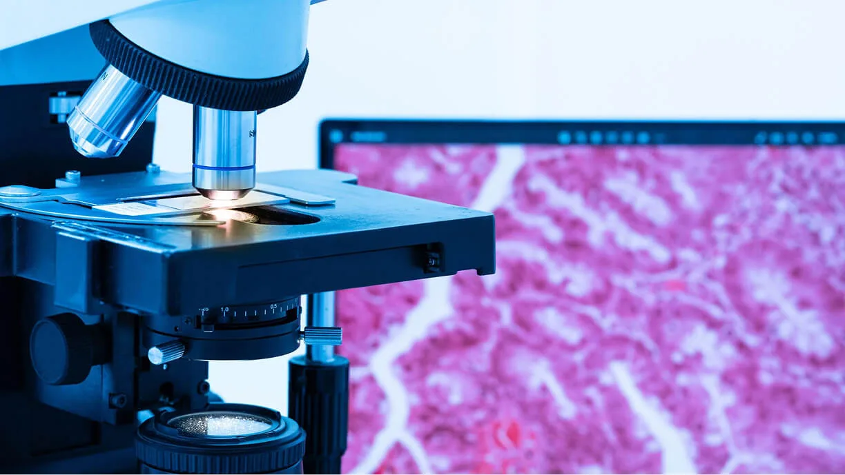 A microscope beside a monitor showing a magnified tissue sample